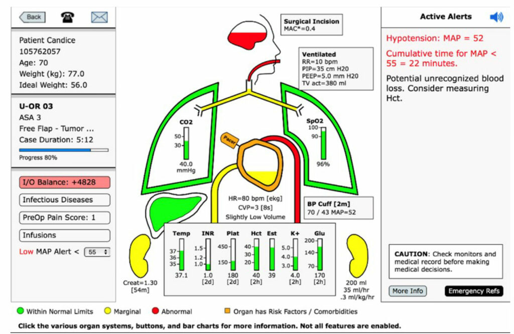 Figure 2. Prototype sample monitor/alert/decision support screen from “Alert-Watch OR.”<sup>18</sup>