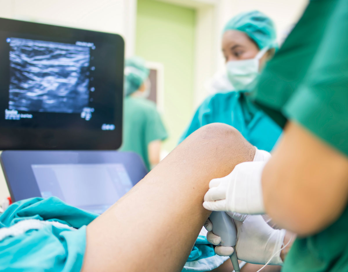 末梢神経ブロックにおける安全性への考慮事項 - Anesthesia