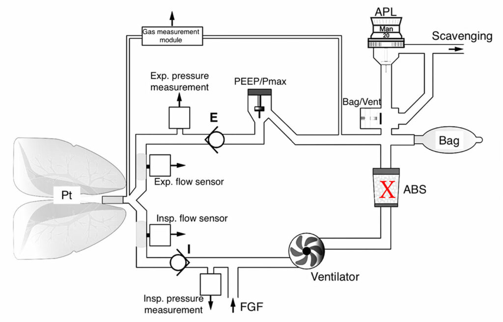 Figure 2: Schematic of Dräger Turbine Type Breathing Circuit (Perseus) with leak site indicated with an X. Mechanical inspiration will continue if there is a canister leak although ambient air can be entrained altering the concentration of gases in the circuit. During exhalation, exhaled and fresh gas will continue to fill the bag. Manual ventilation may be difficult or impossible depending upon the size of the leak. (Courtesy Dräger Medical.) <br /><br />ABS = Absorbent canister; FGF = Fresh gas flow; APL = Adjustable pressure limiting.