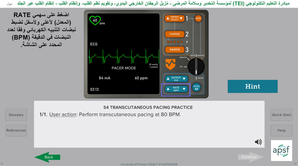الشكل 1: تمرين وضع مزلقة مزيل الرجفان في محاكاة مُزيل الرجفان الخارجي اليدوي، وتقويم نظم القلب، وإنظام القلب.