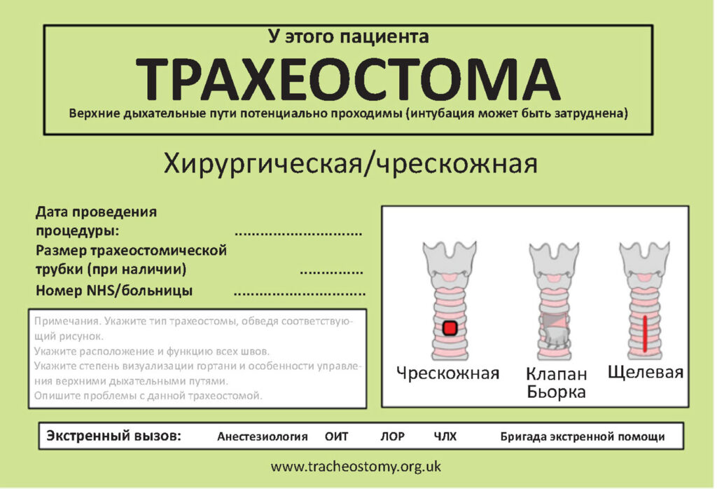 Рис. 4. Табличка с информацией о трахеостомии, которую можно разместить возле постели пациента. Использовано с разрешения Брендана Макграта (Brendan McGrath) и Национального проекта по безопасности трахеостомии (National Tracheostomy Safety Project).