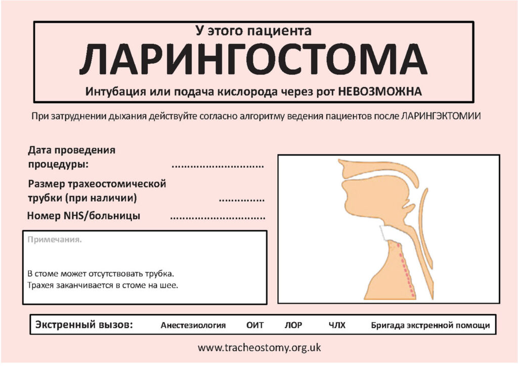 Рис. 5. Табличка с информацией о ларингэктомии, которую можно разместить возле постели пациента. Использовано с разрешения Брендана Макграта (Brendan McGrath) и Национального проекта по безопасности трахеостомии (National Tracheostomy Safety Project).