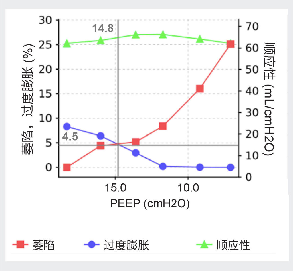 图 4:递减 PEEP 试验期间实变与过度膨胀曲线的 EIT 分析。红色(萎陷)与蓝色(过度膨胀)线的交叉点确定了肺萎陷和过度膨胀的百分比最低的 PEEP 水平。18(经作者许可使用)