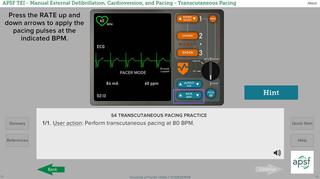 Figure 1: Defibrillator pad placement practice in the MEDCP simulation.