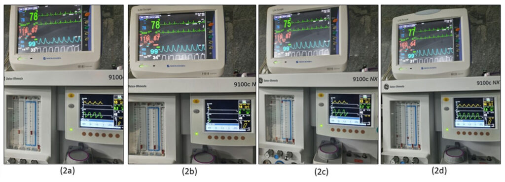 Figure 2: Figures 2(a) to 2(d) show that the variations, however, did not occur after changing the exhausted CO<sub>2</sub> absorbent and correcting rebreathing. The images have been taken while using the same fresh gas flows as in Figure 1a.