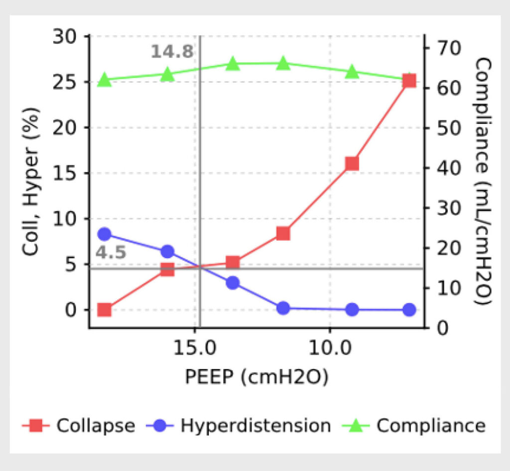 Figure 4: EIT analysis of consolidation versus overdistention curves during a decremental PEEP trial. The crossing point of the red (collapse) and blue (overdistension) lines defines the PEEP level with the lowest percentage of lung collapse and overdistension.18 (Used with permission of the authors.)