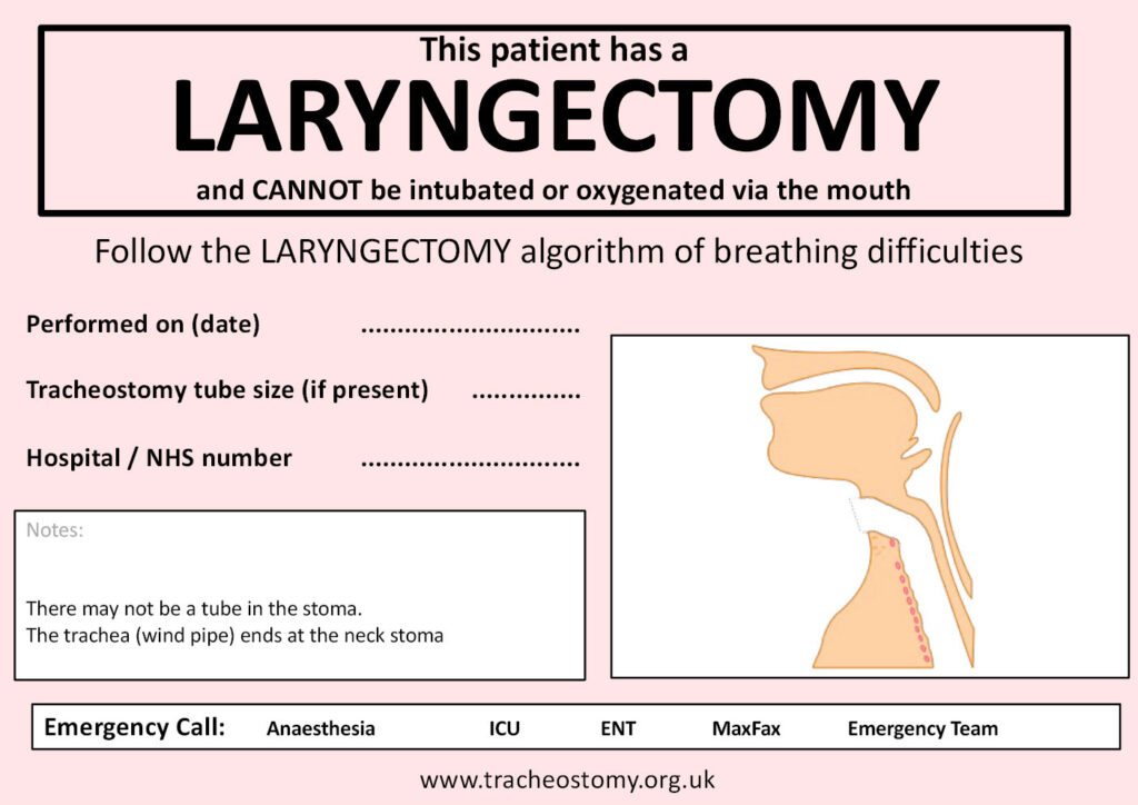 Figure 5: Laryngectomy bedside sign. Used with permission from Brendan McGrath and the National Tracheostomy Safety Project.