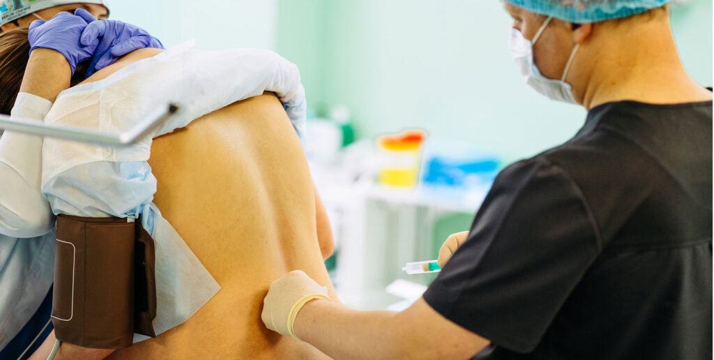 Epidural