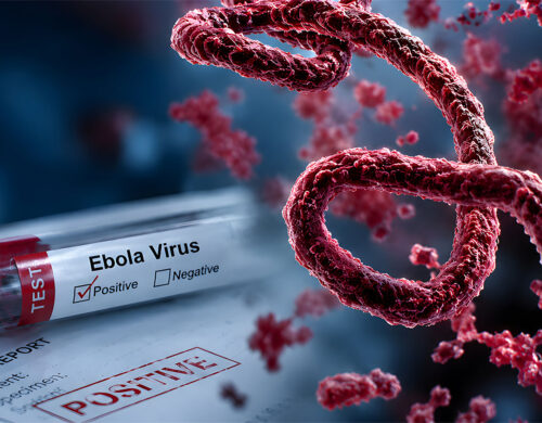 Ebola and the Anesthesia Professional: Practical Considerations During the Current Bundibugyo Virus Outbreak
