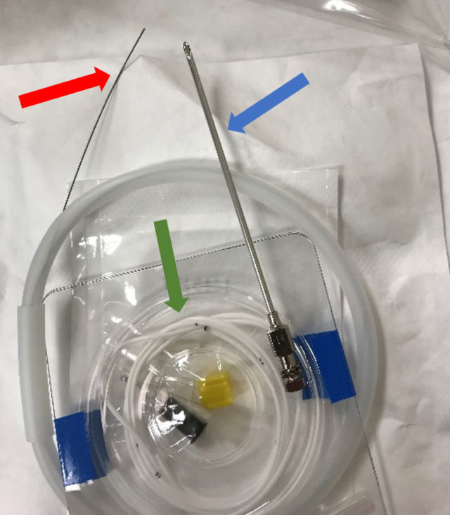Inability to retract guidewire from catheter during lumbar CSF drain