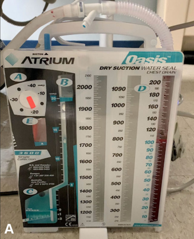 Chest Tube Atrium Setup