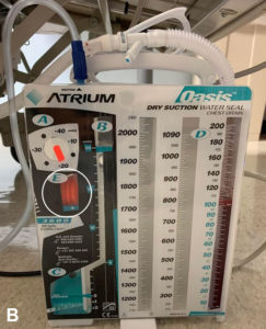 <strong>B.</strong> Chest tube apparatus with suction applied. Note the expansion of the orange bellows beyond the triangular indicator in section E, providing visual confirmation of active suction (white circle).