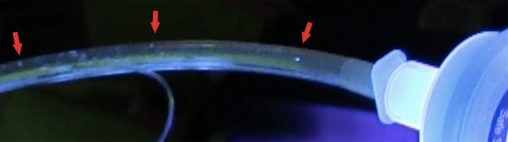 Figure 3. Glo Germ particles shown in ETT (red arrows).