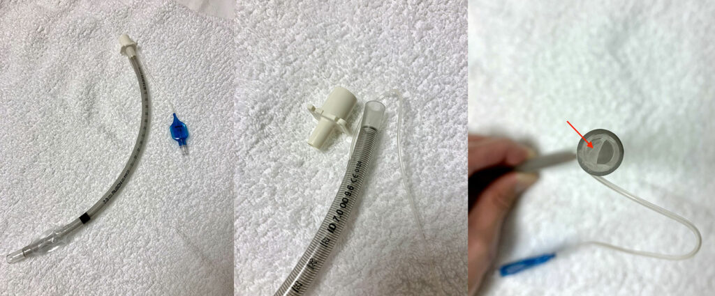 Figure 1: Armored endotracheal tube with universal connector detached revealing adhesive remnant, previously used to bind universal connector to endotracheal tube