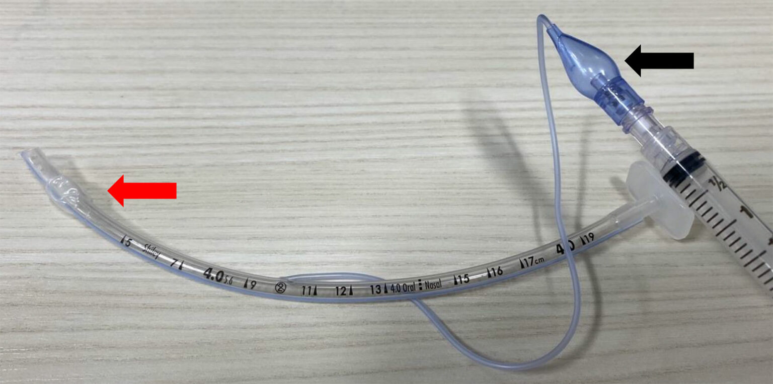 Unusual Cause of Endotracheal Tube Cuff Inflation Failure Anesthesia